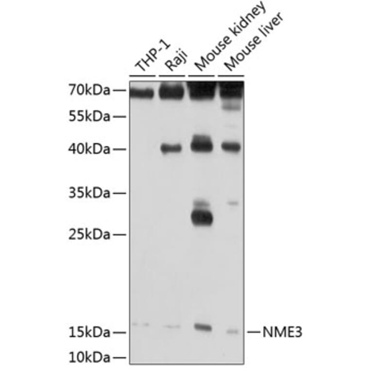 Western Blot - Anti-NME3 Antibody (A14183) - Antibodies.com