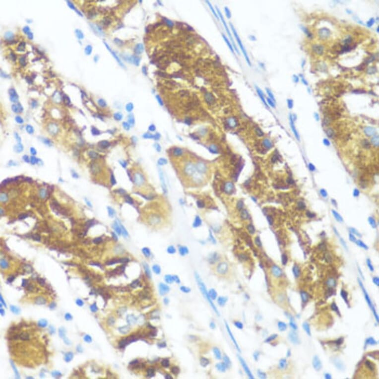 Immunohistochemistry - Anti-NME3 Antibody (A14183) - Antibodies.com