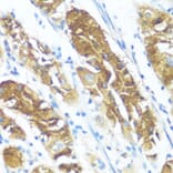 Immunohistochemistry - Anti-NME3 Antibody (A14183) - Antibodies.com