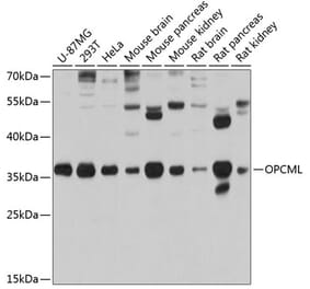 Western Blot - Anti-OPCML Antibody (A14185) - Antibodies.com