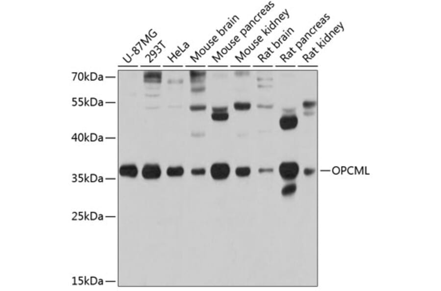 Western Blot - Anti-OPCML Antibody (A14185) - Antibodies.com