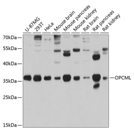 Western Blot - Anti-OPCML Antibody (A14185) - Antibodies.com