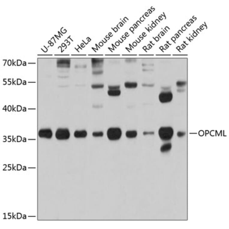 Western Blot - Anti-OPCML Antibody (A14185) - Antibodies.com