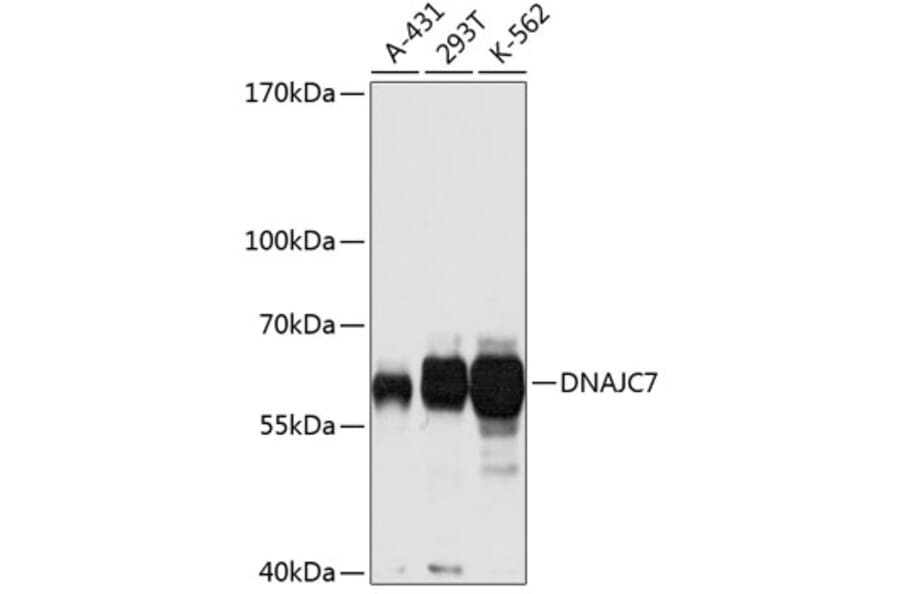 Western Blot - Anti-DNAJC7 Antibody (A14186) - Antibodies.com