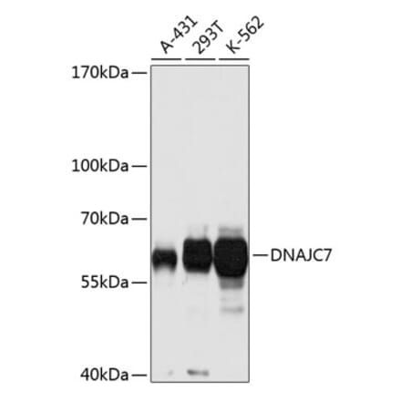 Western Blot - Anti-DNAJC7 Antibody (A14186) - Antibodies.com