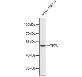 Western Blot - Anti-p73 Antibody (A14187) - Antibodies.com