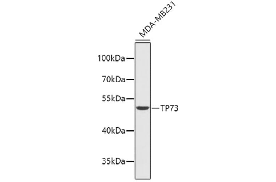 Western Blot - Anti-p73 Antibody (A14187) - Antibodies.com