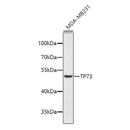 Western Blot - Anti-p73 Antibody (A14187) - Antibodies.com