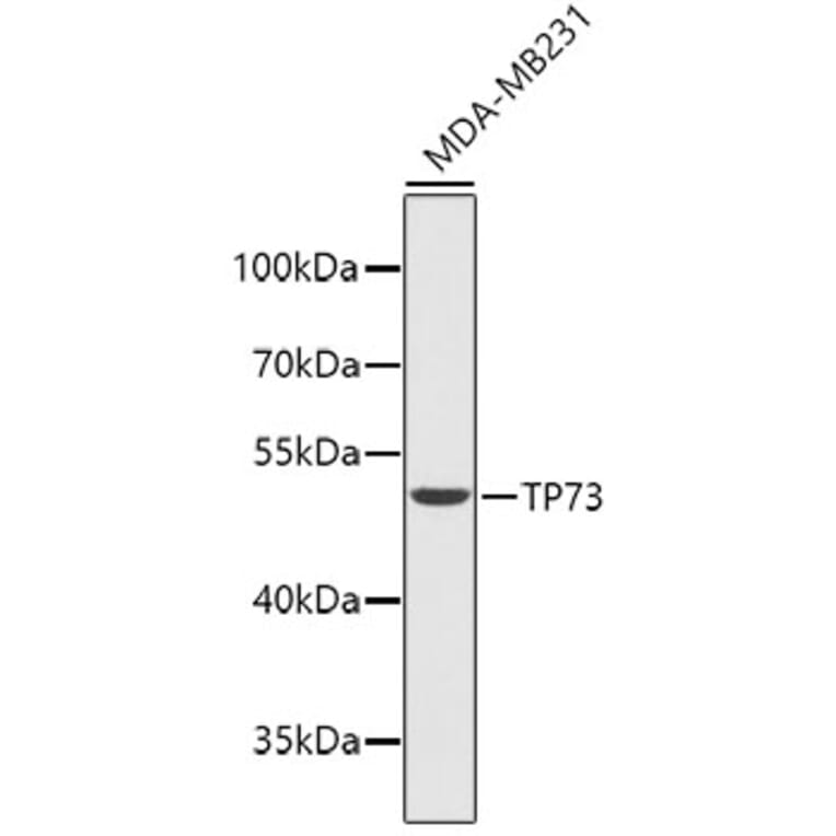 Western Blot - Anti-p73 Antibody (A14187) - Antibodies.com