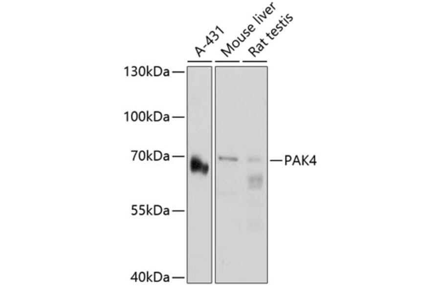Western Blot - Anti-PAK4 Antibody (A2782) - Antibodies.com