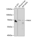 Western Blot - Anti-PAK4 Antibody (A2782) - Antibodies.com