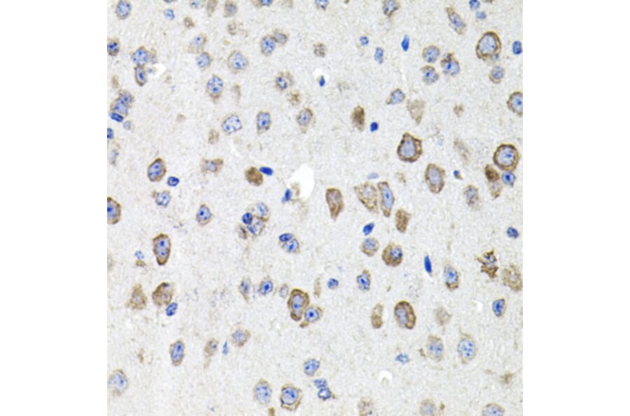Immunohistochemistry - Anti-CDH23 Antibody (A14191) - Antibodies.com