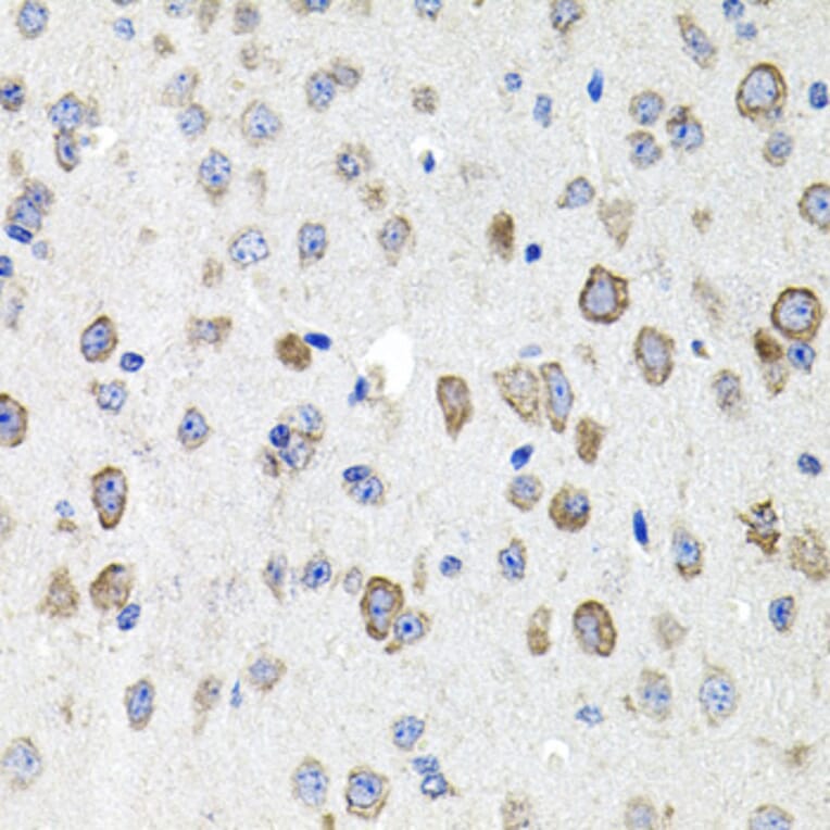 Immunohistochemistry - Anti-CDH23 Antibody (A14191) - Antibodies.com