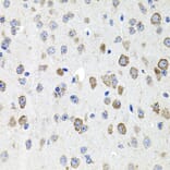 Immunohistochemistry - Anti-CDH23 Antibody (A14191) - Antibodies.com