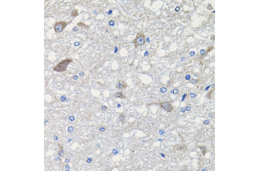 Immunohistochemistry - Anti-CDH23 Antibody (A14191) - Antibodies.com