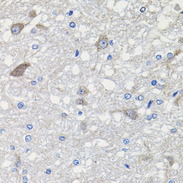 Immunohistochemistry - Anti-CDH23 Antibody (A14191) - Antibodies.com
