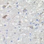 Immunohistochemistry - Anti-CDH23 Antibody (A14191) - Antibodies.com