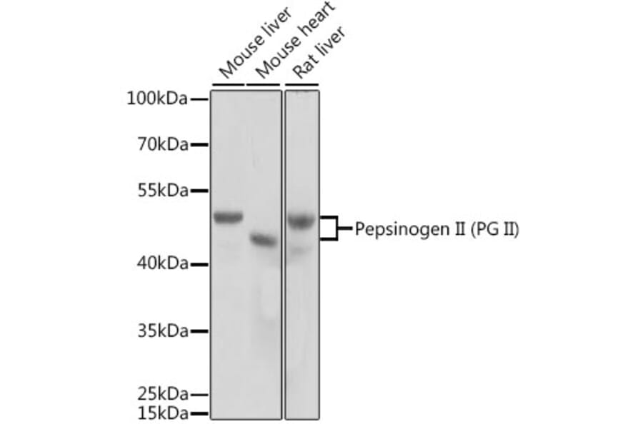 Western Blot - Anti-Pepsinogen II/PGC Antibody (A14193) - Antibodies.com