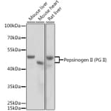 Western Blot - Anti-Pepsinogen II/PGC Antibody (A14193) - Antibodies.com