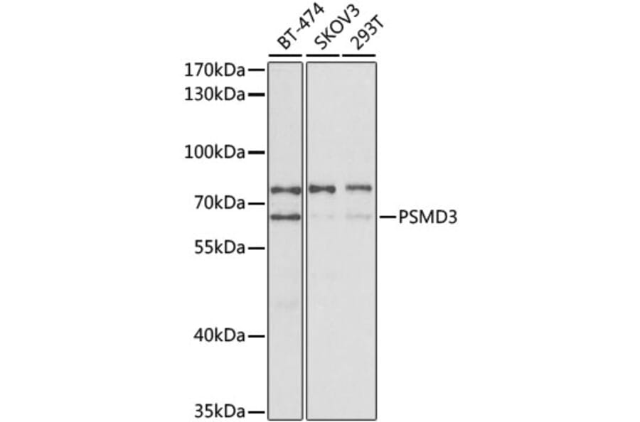 Western Blot - Anti-Proteasome 26S S3/PSMD3 Antibody (A14194) - Antibodies.com