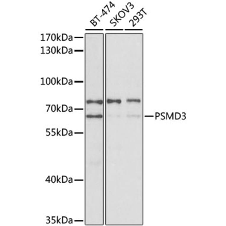 Western Blot - Anti-Proteasome 26S S3/PSMD3 Antibody (A14194) - Antibodies.com