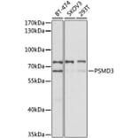 Western Blot - Anti-Proteasome 26S S3/PSMD3 Antibody (A14194) - Antibodies.com