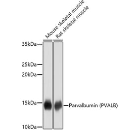 Western Blot - Anti-Parvalbumin Antibody (A14195) - Antibodies.com