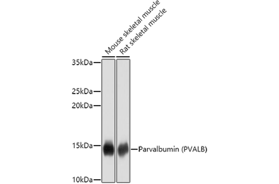 Western Blot - Anti-Parvalbumin Antibody (A14195) - Antibodies.com