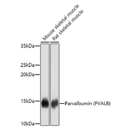 Western Blot - Anti-Parvalbumin Antibody (A14195) - Antibodies.com