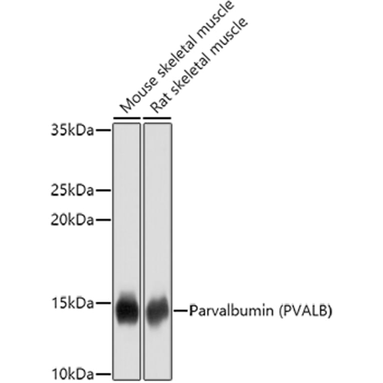 Western Blot - Anti-Parvalbumin Antibody (A14195) - Antibodies.com