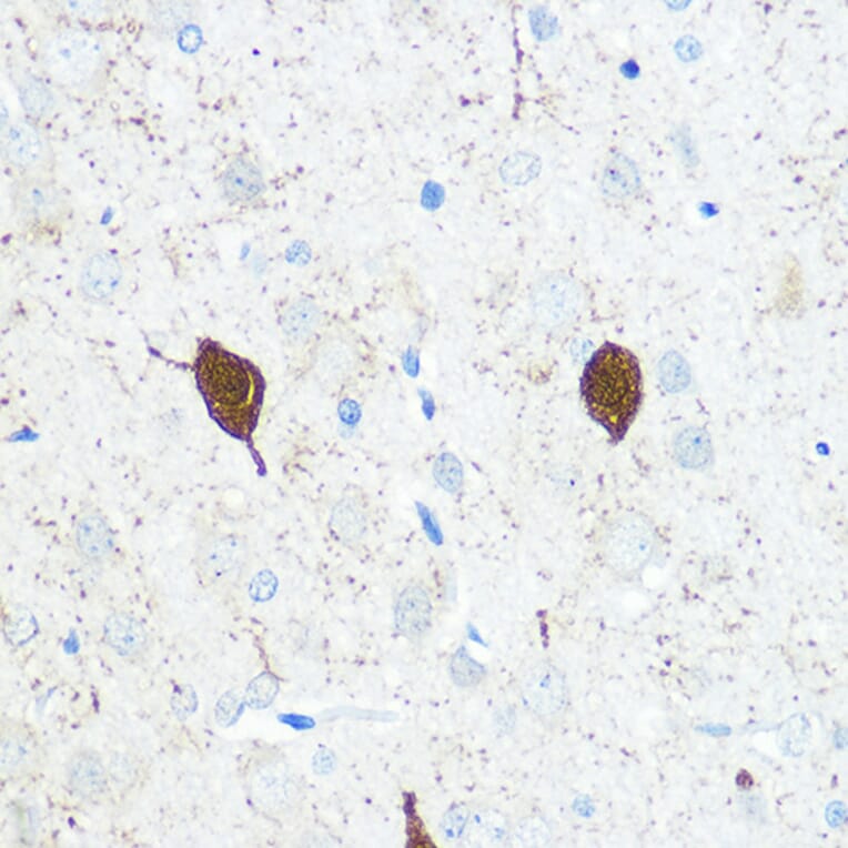 Immunohistochemistry - Anti-Parvalbumin Antibody (A14195) - Antibodies.com