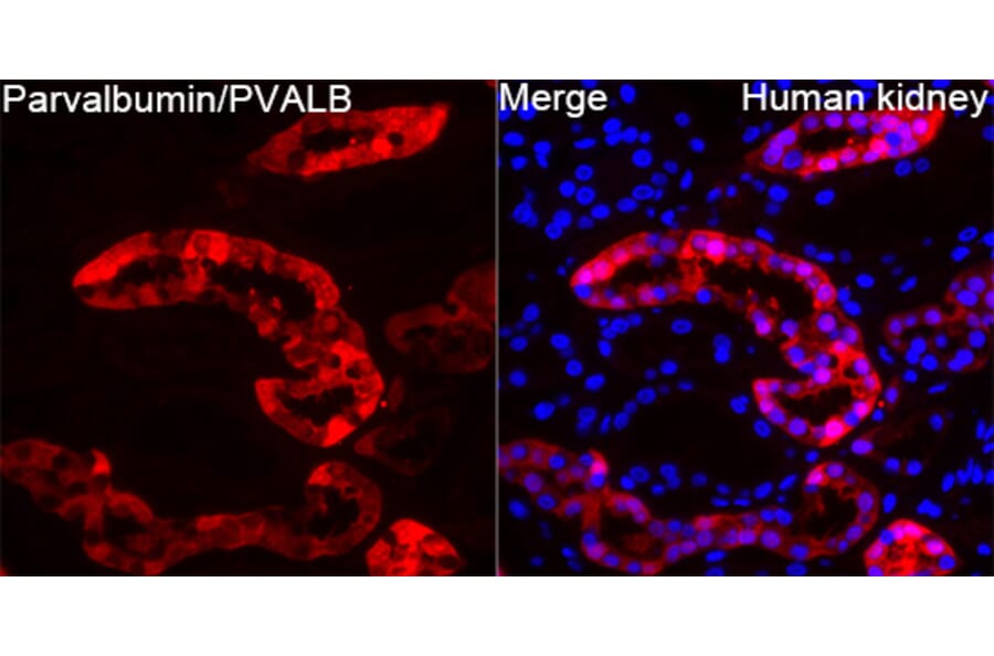 Immunofluorescence - Anti-Parvalbumin Antibody (A14195) - Antibodies.com