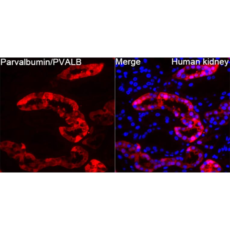 Immunofluorescence - Anti-Parvalbumin Antibody (A14195) - Antibodies.com