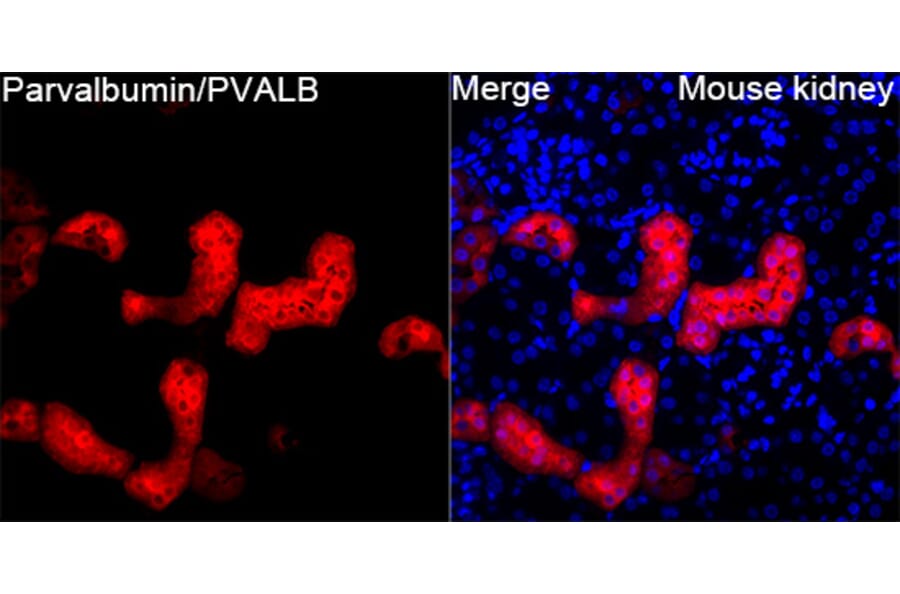 Immunofluorescence - Anti-Parvalbumin Antibody (A14195) - Antibodies.com