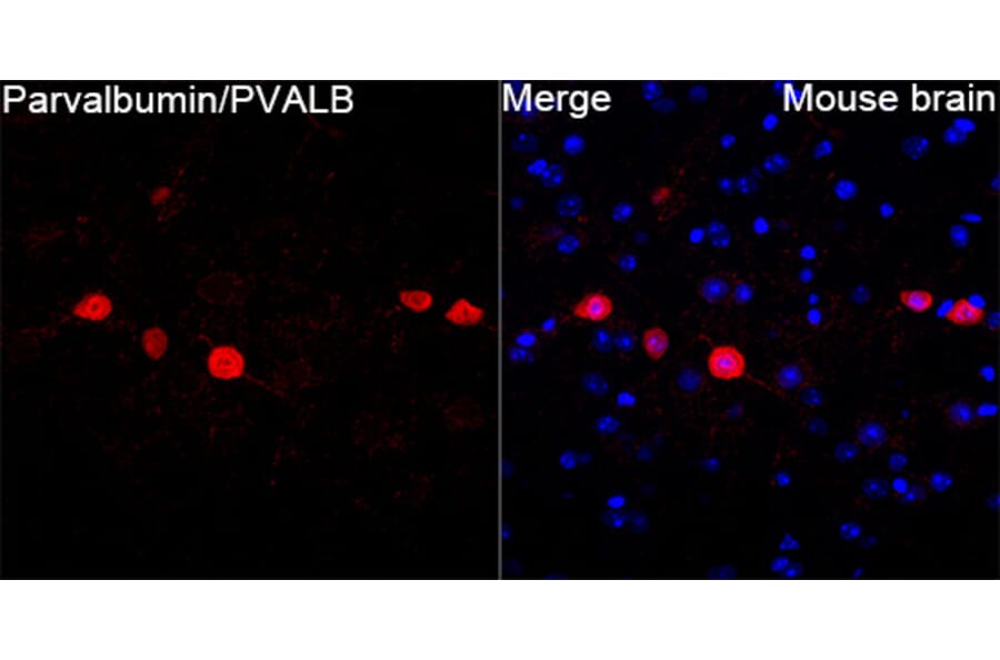 Immunofluorescence - Anti-Parvalbumin Antibody (A14195) - Antibodies.com