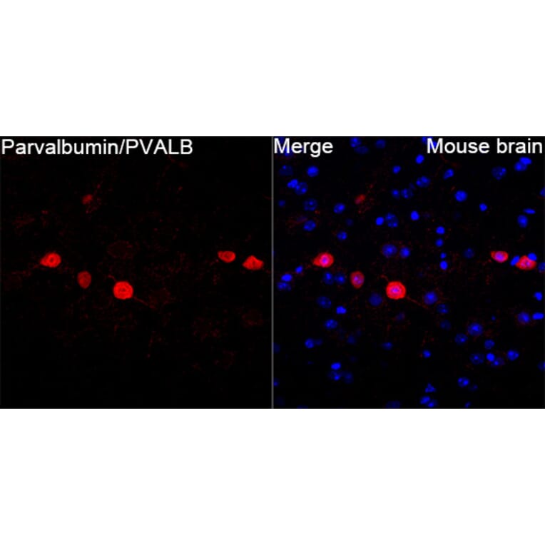 Immunofluorescence - Anti-Parvalbumin Antibody (A14195) - Antibodies.com