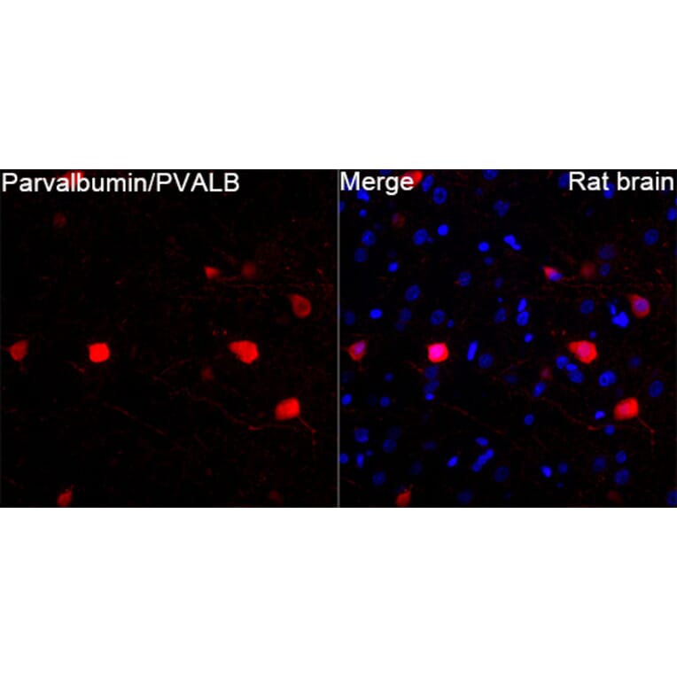 Immunofluorescence - Anti-Parvalbumin Antibody (A14195) - Antibodies.com