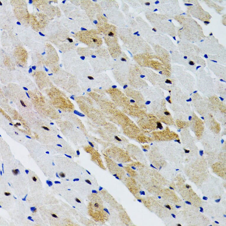 Immunohistochemistry - Anti-SHP2 Antibody (A14197) - Antibodies.com
