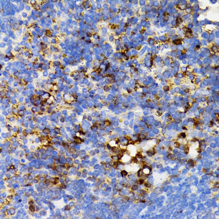 Immunohistochemistry - Anti-SHP2 Antibody (A14197) - Antibodies.com
