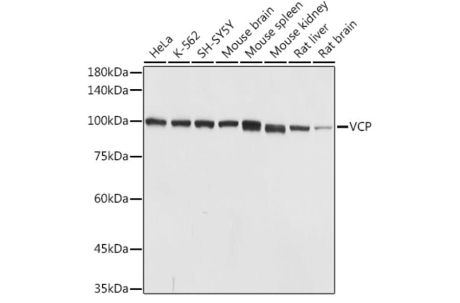 Western Blot - Anti-VCP Antibody (A14198) - Antibodies.com