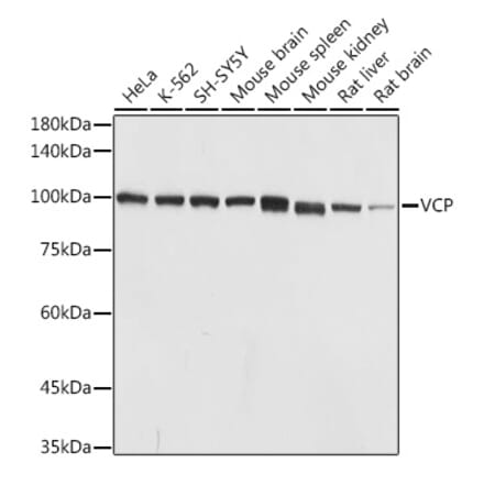 Western Blot - Anti-VCP Antibody (A14198) - Antibodies.com