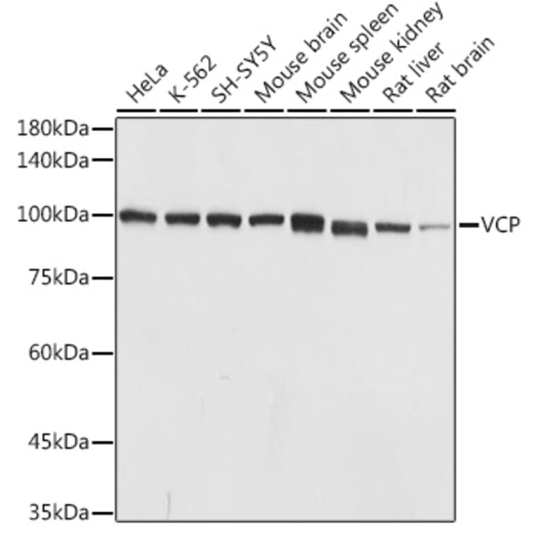 Western Blot - Anti-VCP Antibody (A14198) - Antibodies.com