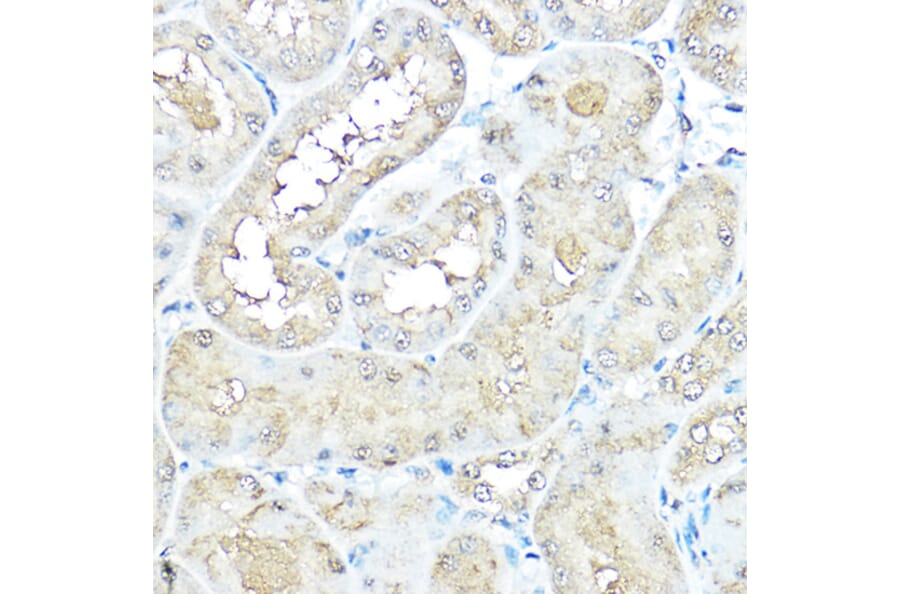 Immunohistochemistry - Anti-VCP Antibody (A14198) - Antibodies.com
