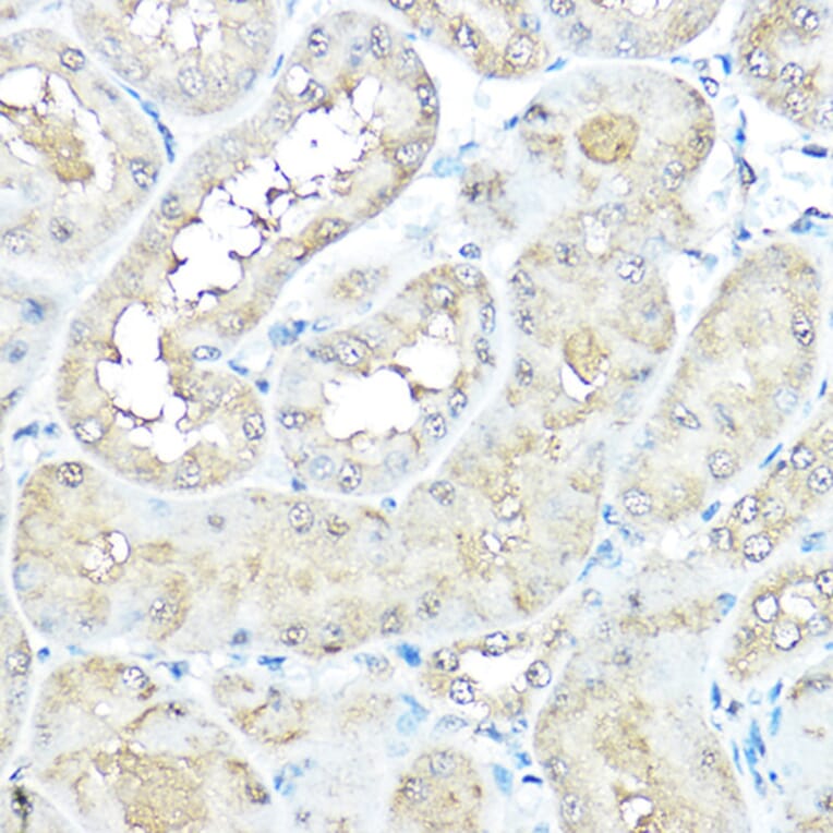 Immunohistochemistry - Anti-VCP Antibody (A14198) - Antibodies.com