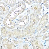 Immunohistochemistry - Anti-VCP Antibody (A14198) - Antibodies.com