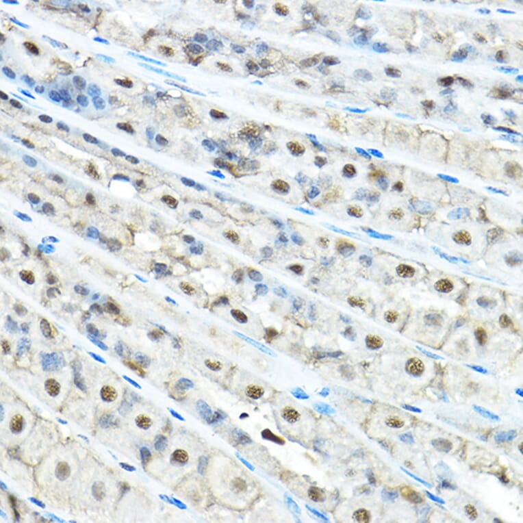 Immunohistochemistry - Anti-VCP Antibody (A14198) - Antibodies.com