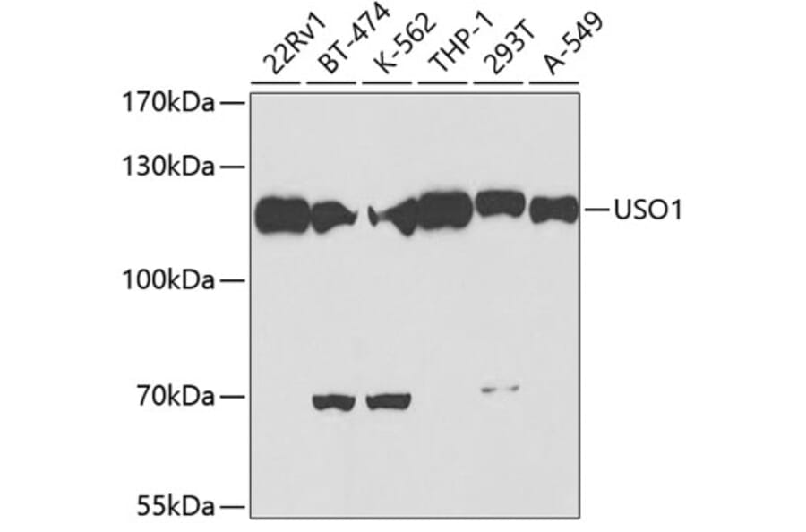 Western Blot - Anti-USO1 Antibody (A2796) - Antibodies.com