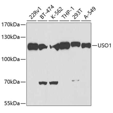 Western Blot - Anti-USO1 Antibody (A2796) - Antibodies.com