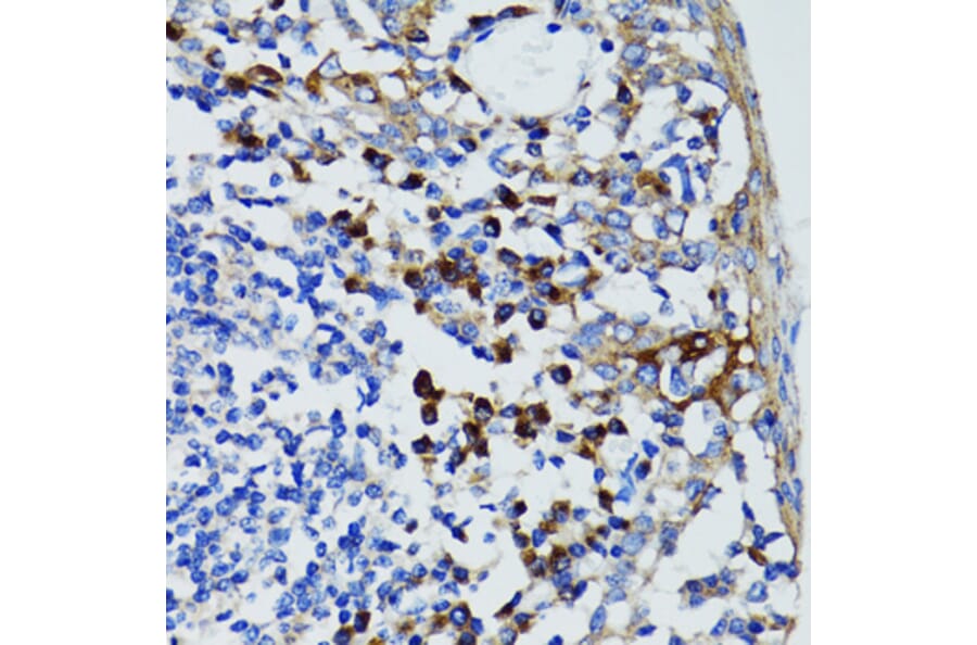 Immunohistochemistry - Anti-USO1 Antibody (A2796) - Antibodies.com