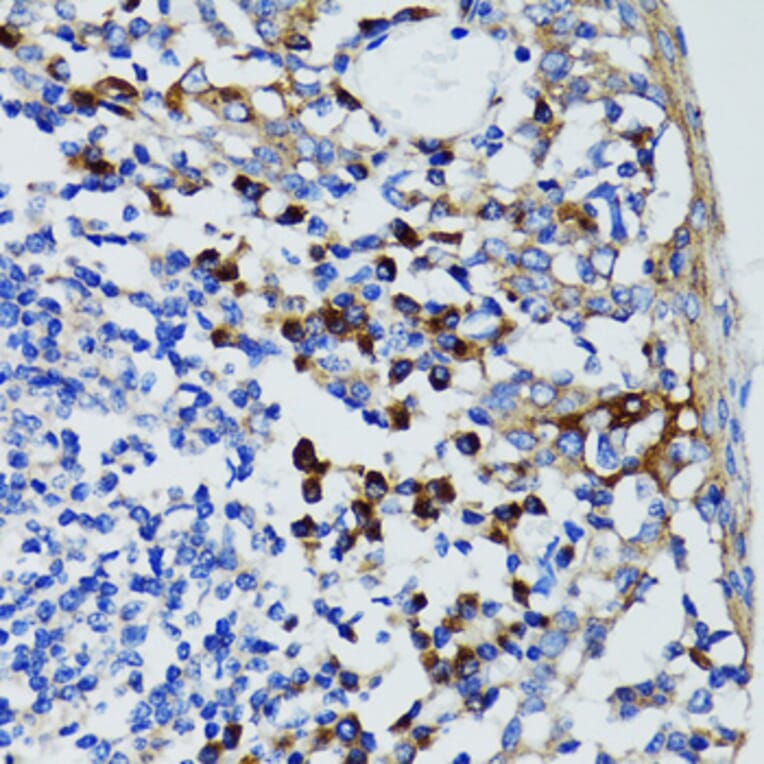 Immunohistochemistry - Anti-USO1 Antibody (A2796) - Antibodies.com